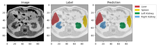 CHAOS Organ Segmentation